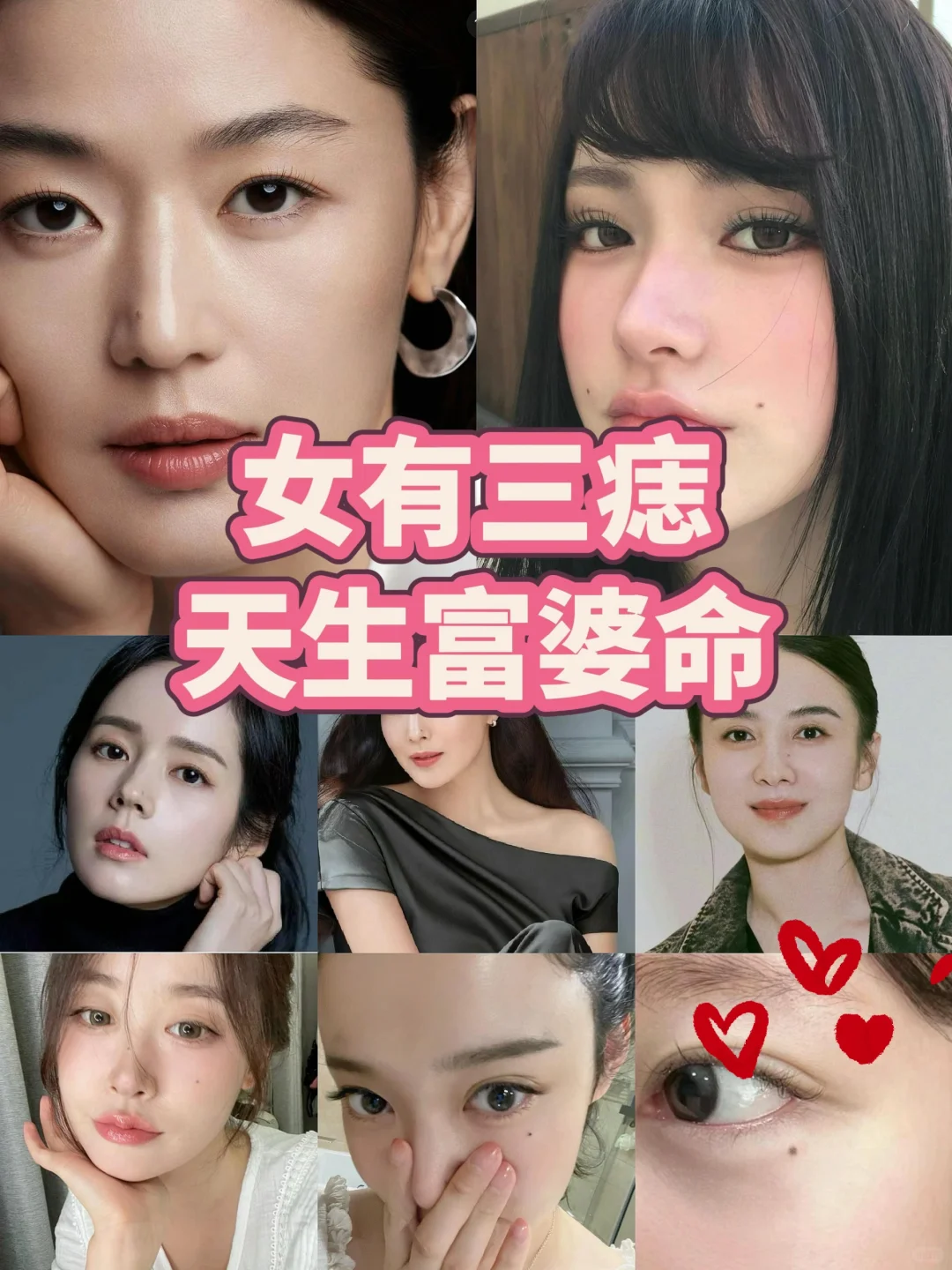 速记，如何区分好坏痣❗️❗️