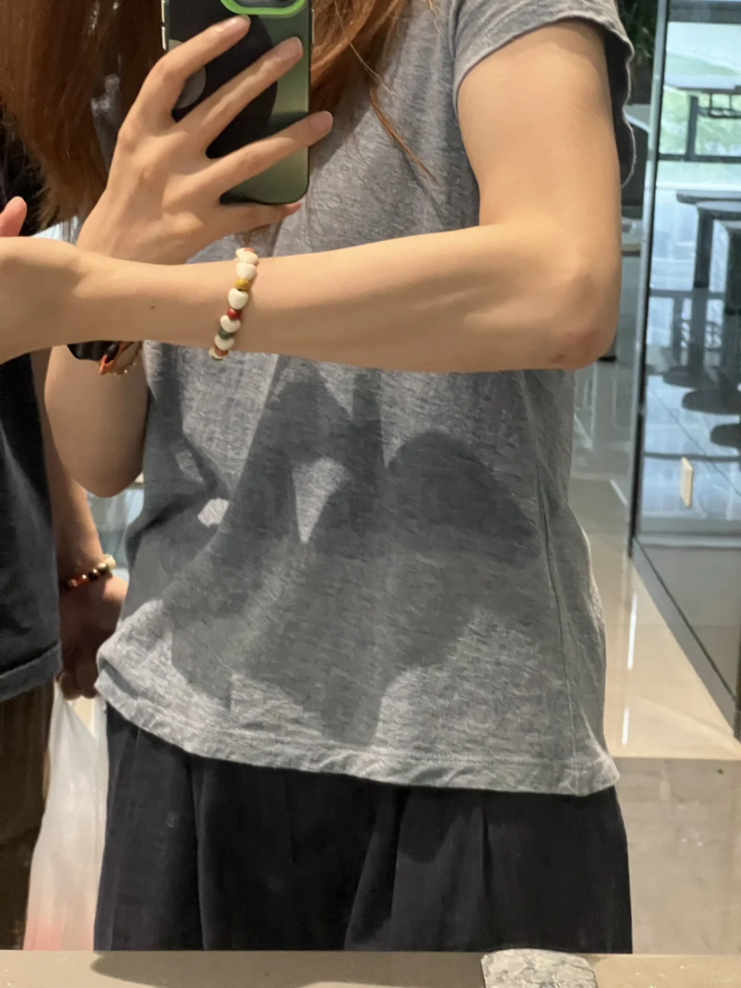 手臂这是拉丝了吗