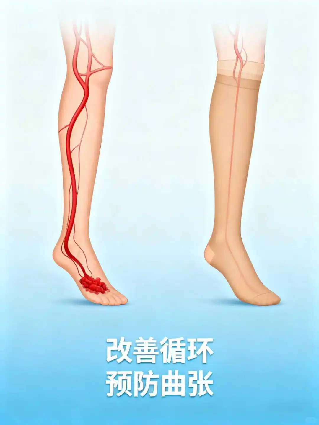 医用弹力袜：给血管减负，呵护双腿健康