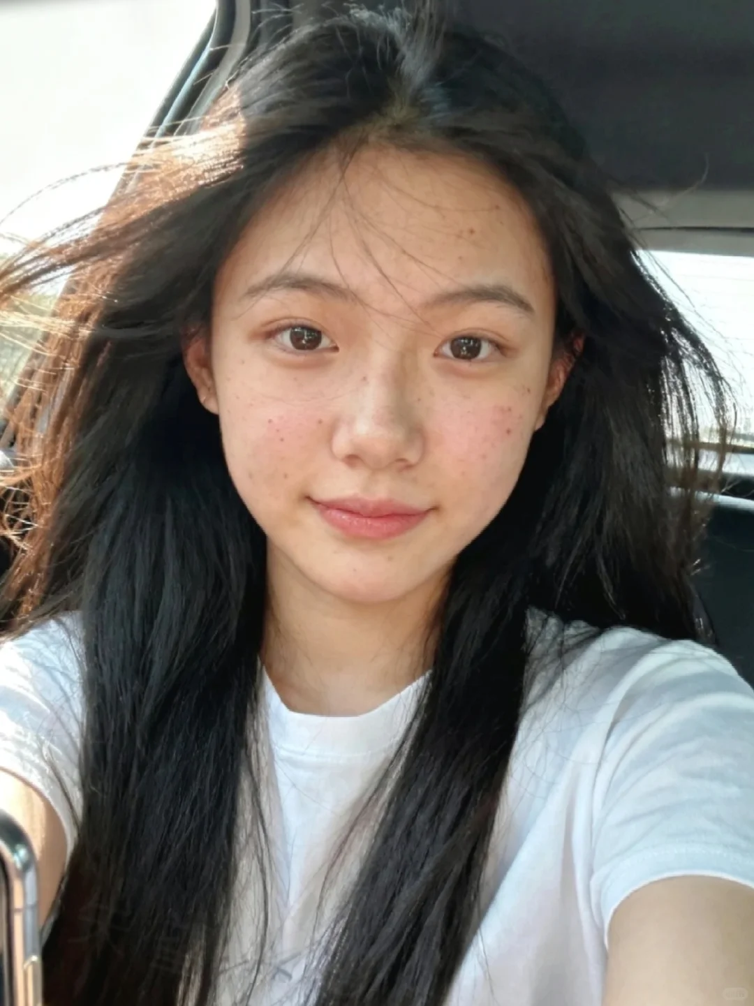 痘痘…素颜也是漂亮的吧?