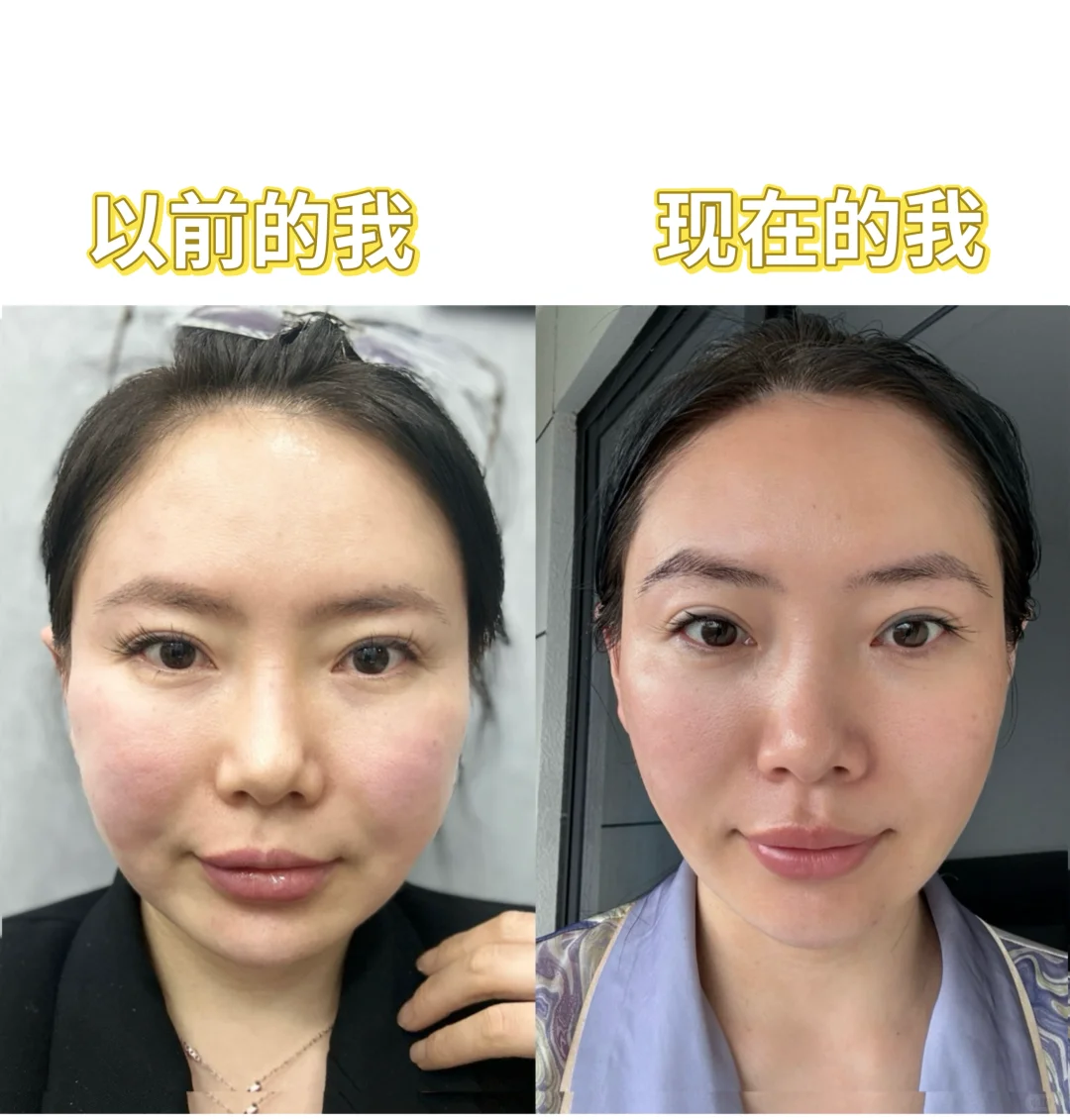“馒头脸”自救上岸！