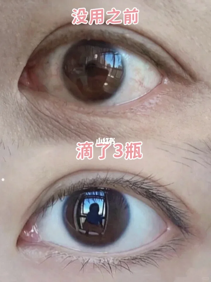 润眼液爱马仕🌟水润透白超诱人