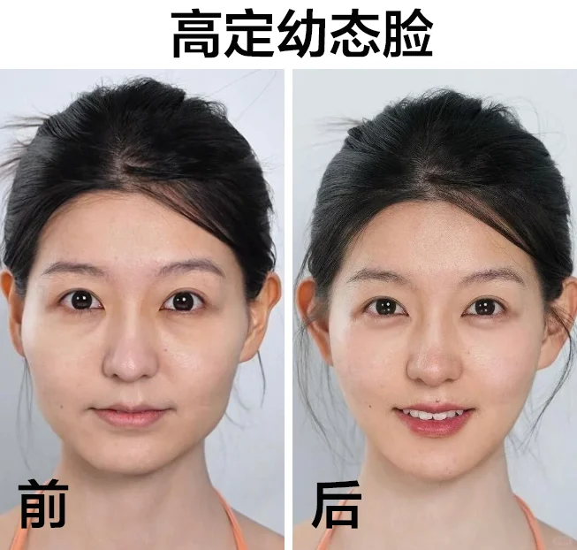 方圆脸女生都去试试“幼态脸”！颜值天花板