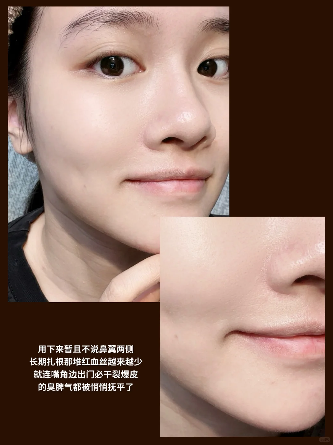 脱颖而出的秋冬烂脸尤物