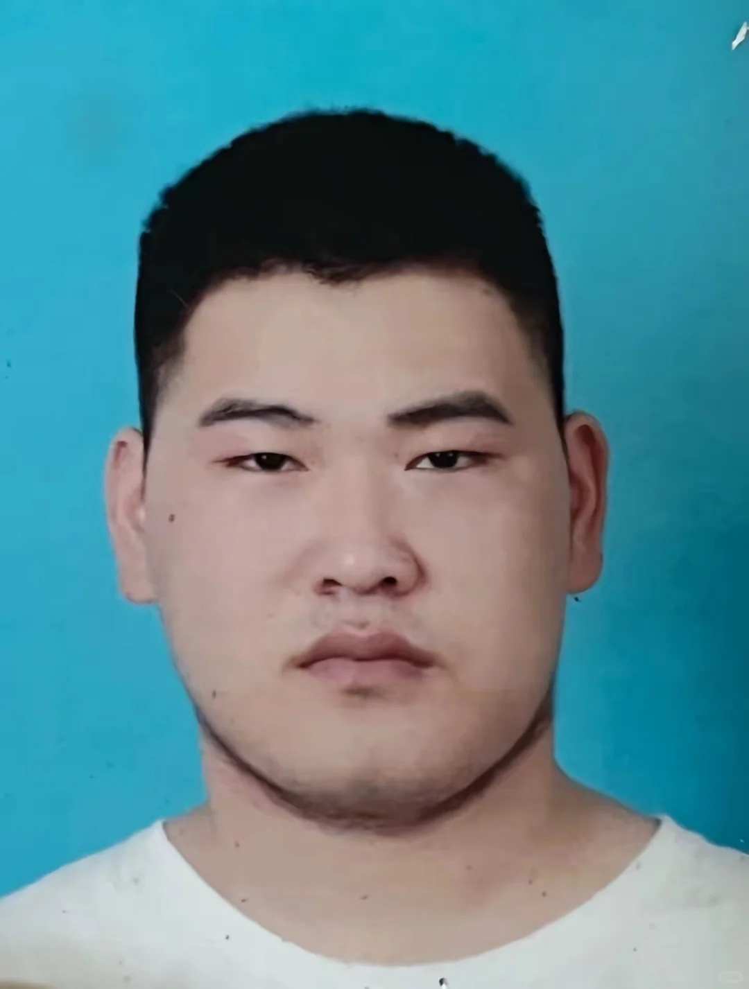 已瘦70斤的面部对比