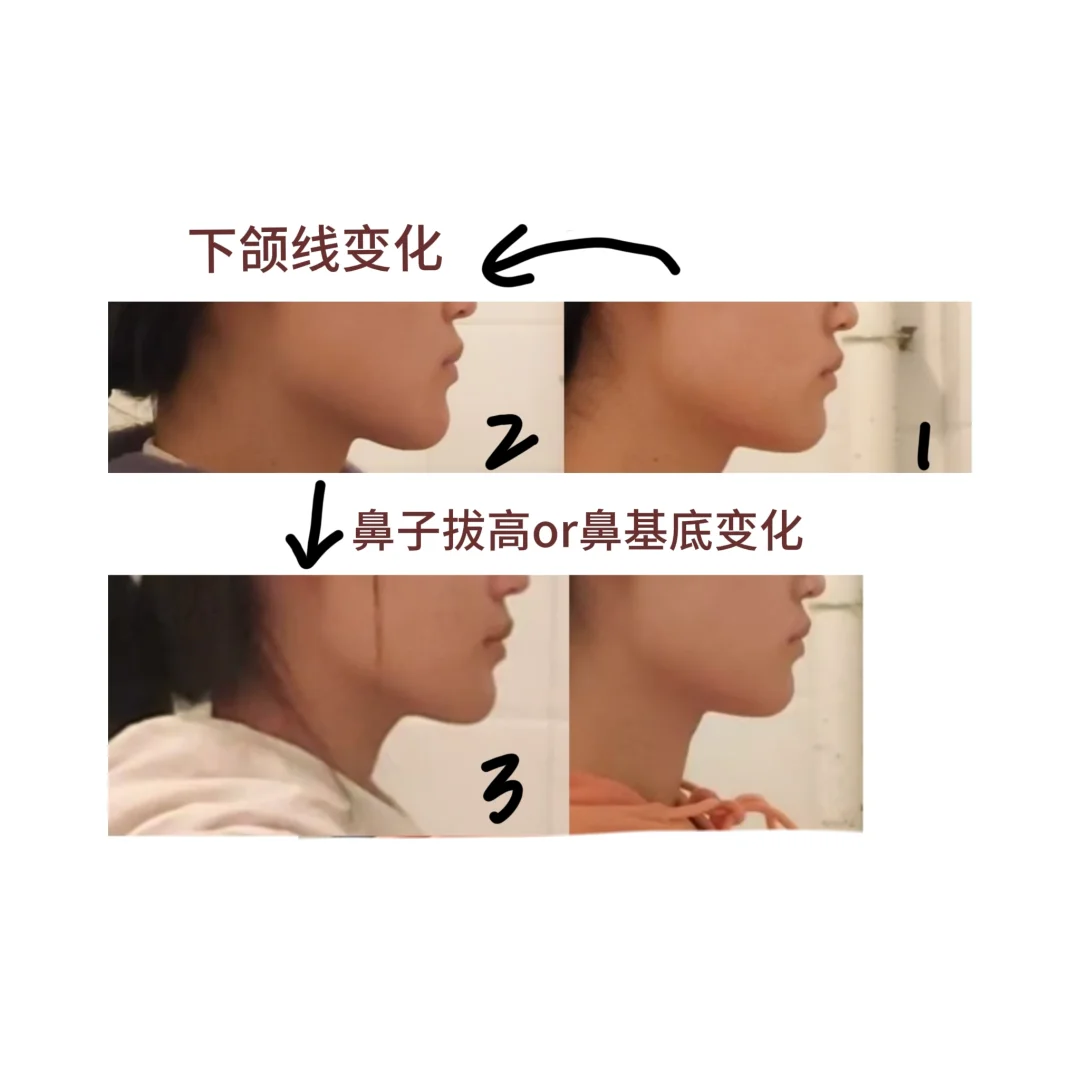一个月骨相速成sub来啦
