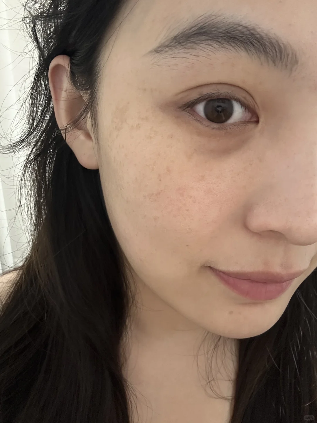 维生素e淡斑第🔟天