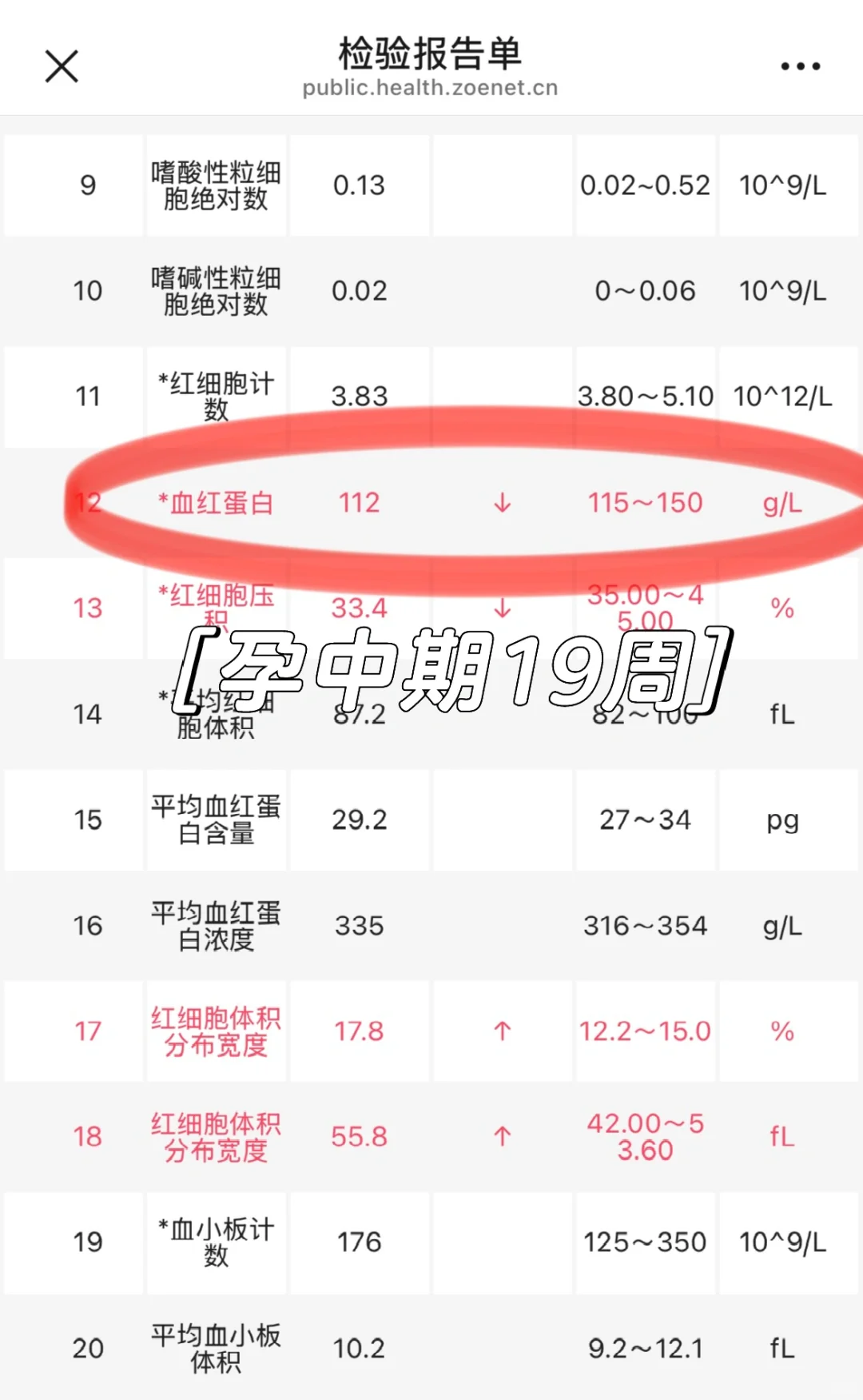 中度贫血大作战|孕期补铁踩过的坑