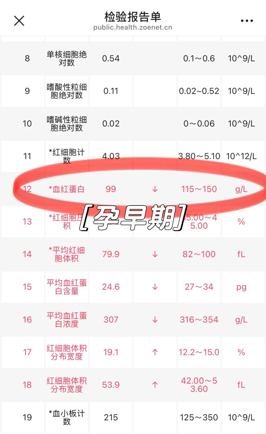中度贫血大作战|孕期补铁踩过的坑