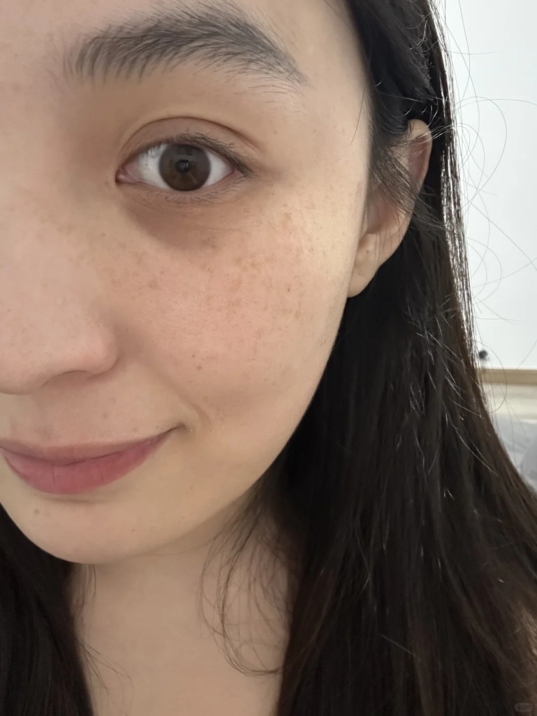 维生素e淡斑第🔟天