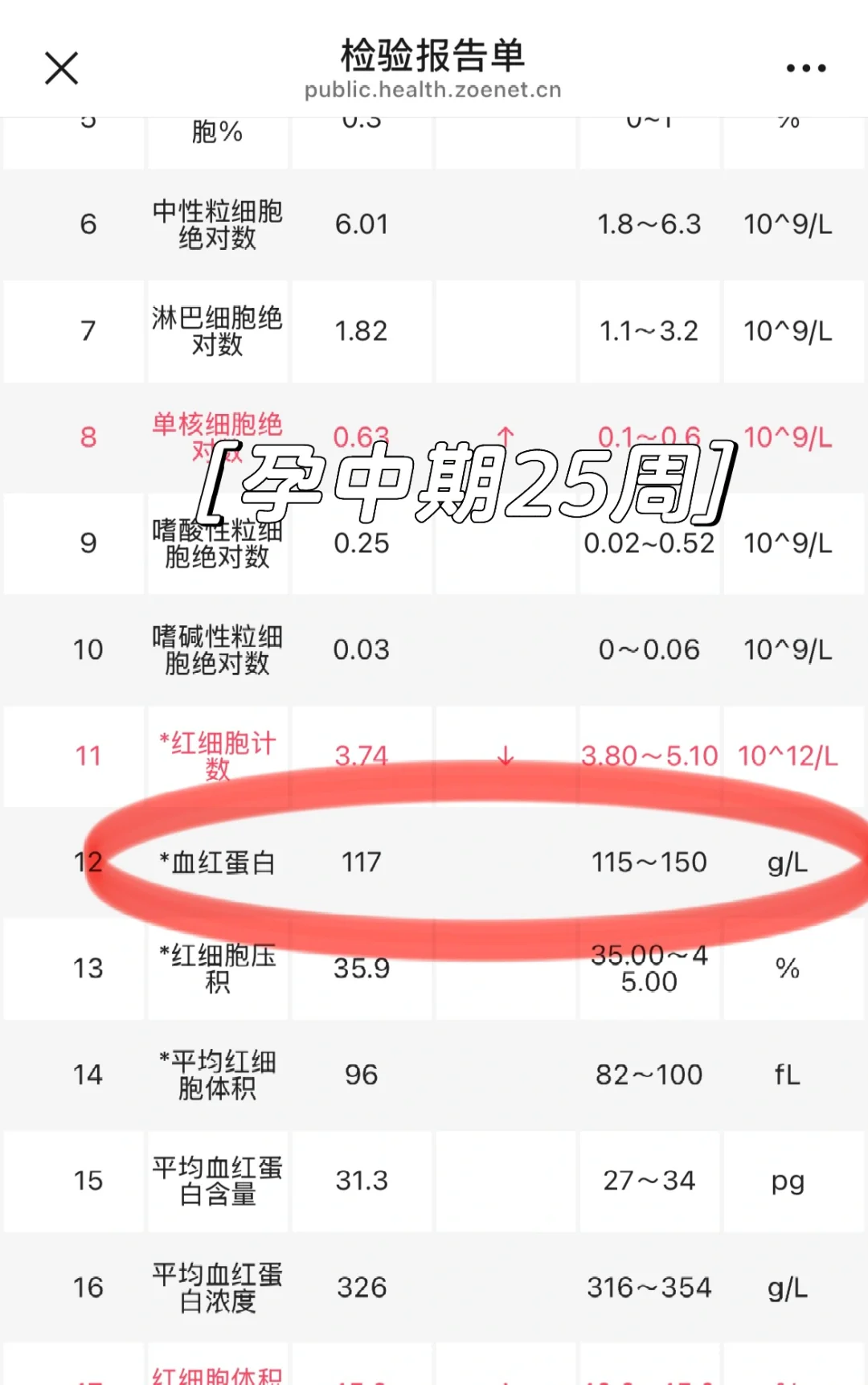 中度贫血大作战|孕期补铁踩过的坑