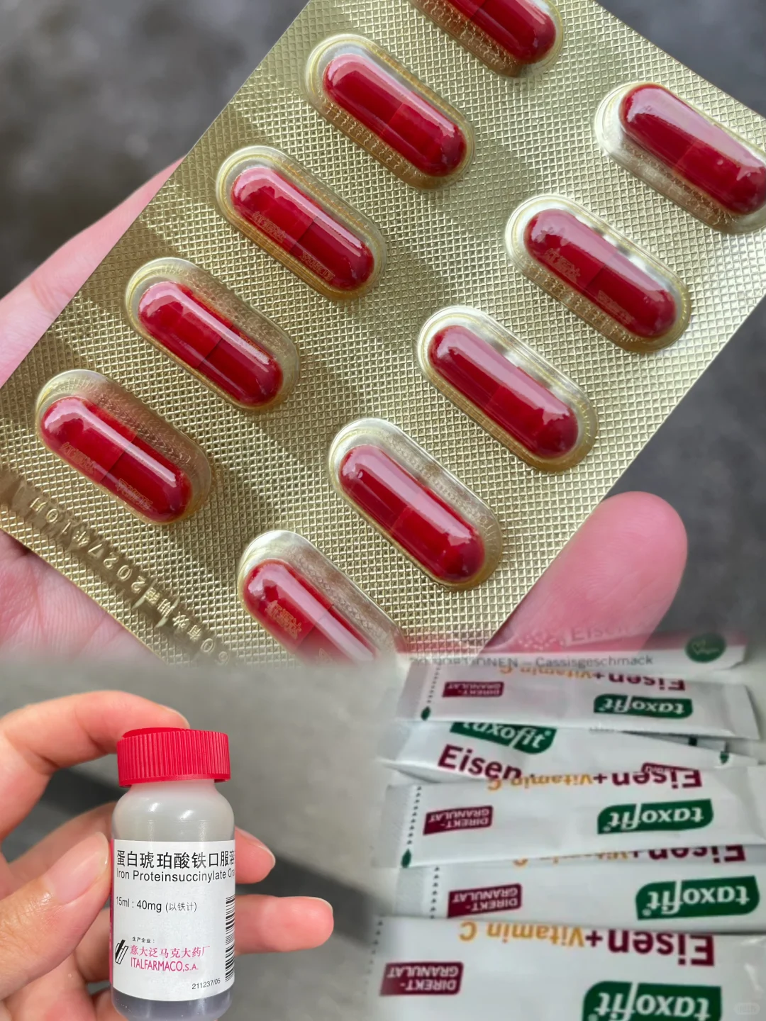 中度贫血大作战|孕期补铁踩过的坑