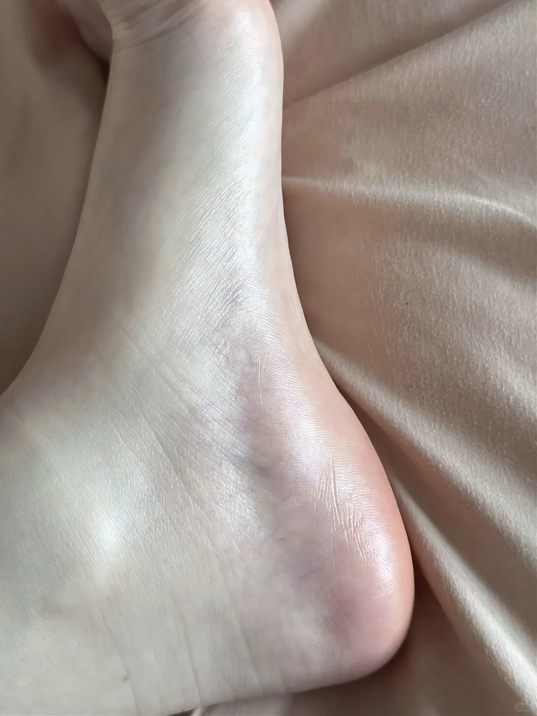 我的脚终于能配得上我的凉鞋啦！！