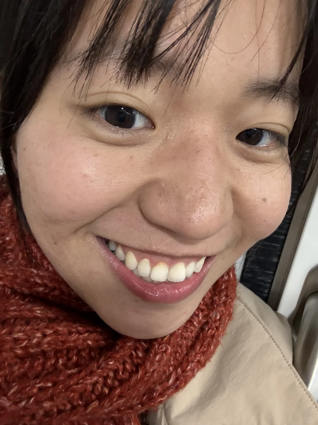 喜欢雀斑、牙套、自然卷、粗壮的小腿。