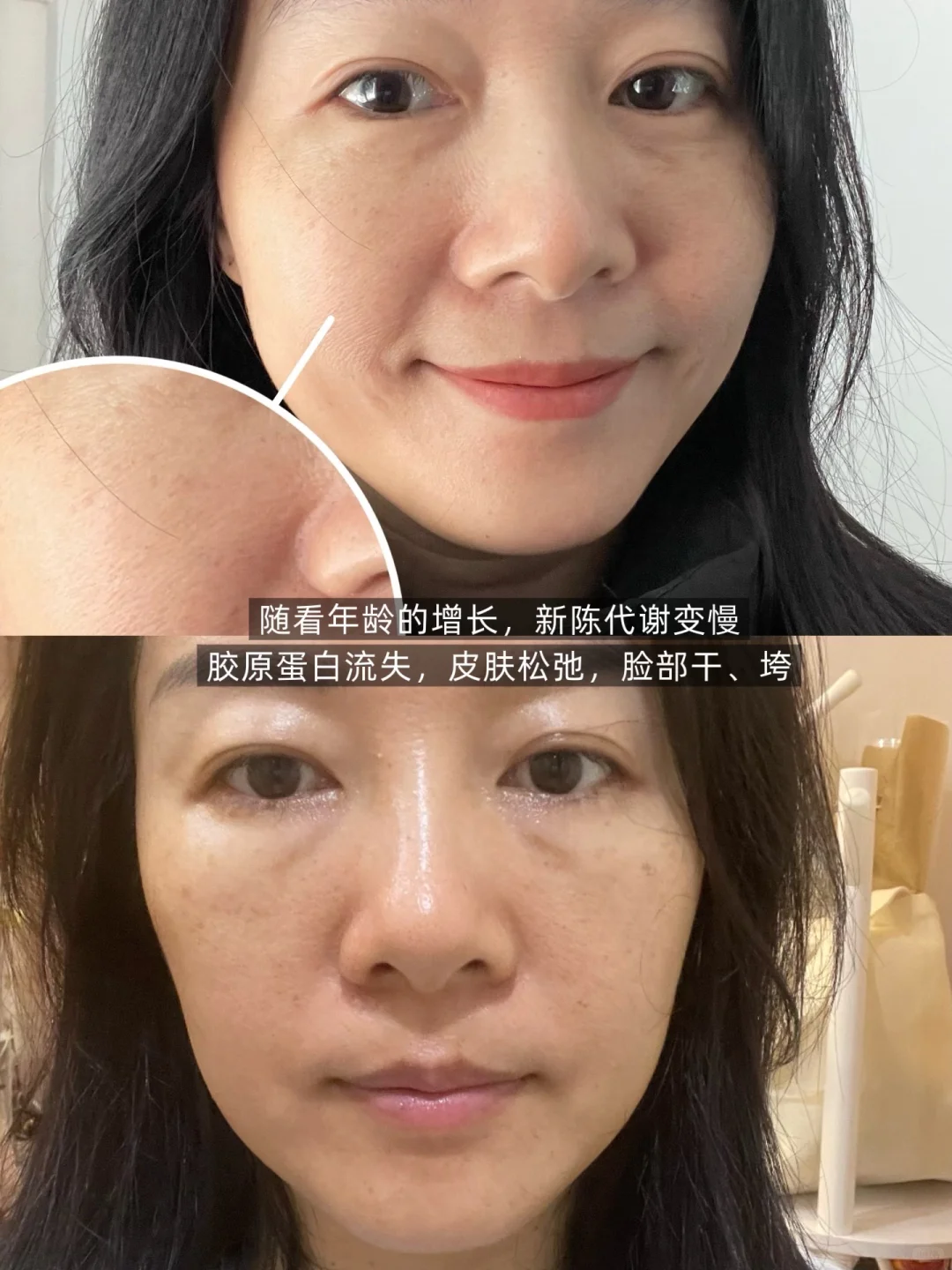 42岁，跳绳+以油养肤少女感是我应得的