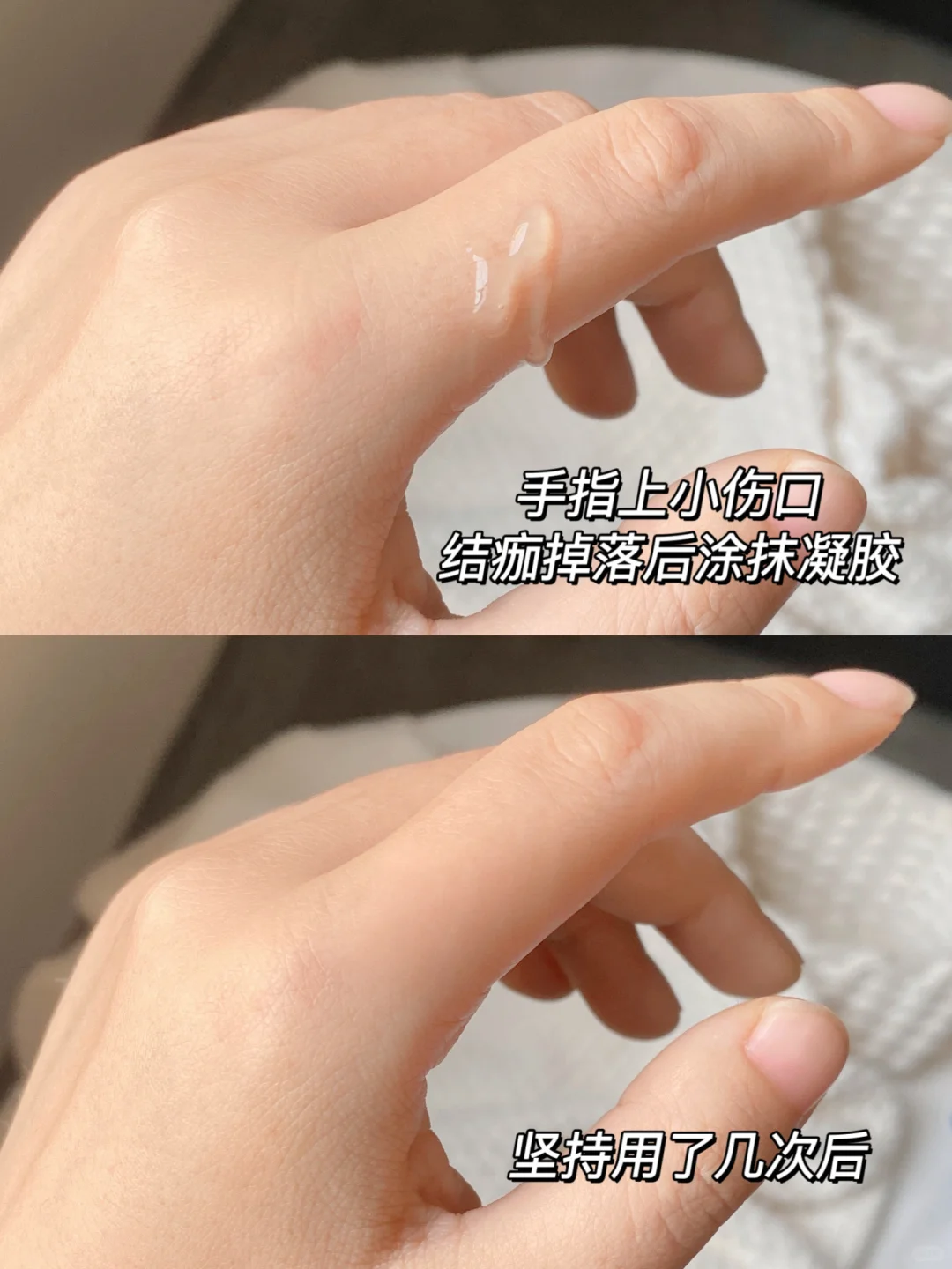 芭克 我的秘密武器