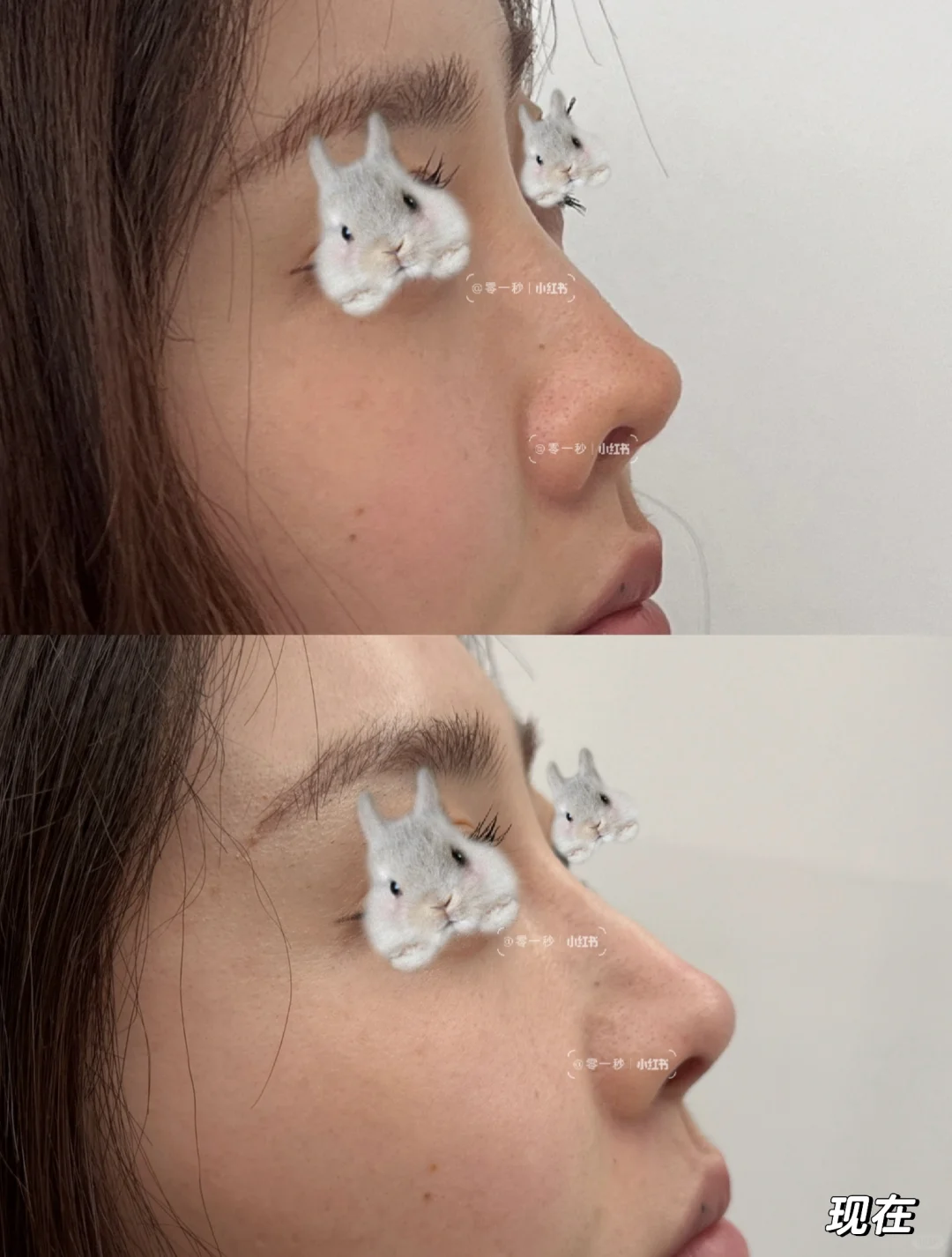 蟹蟹💉是有点香，能看出来变化吧？