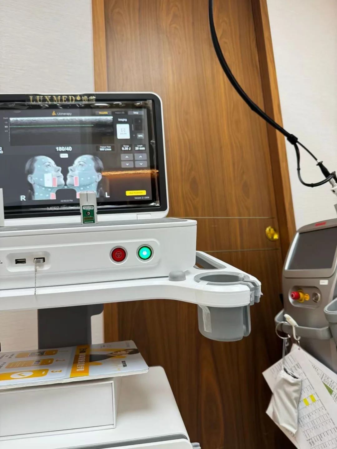 30 + 肉脸自救！🇲🇴美超一个月反馈真的香