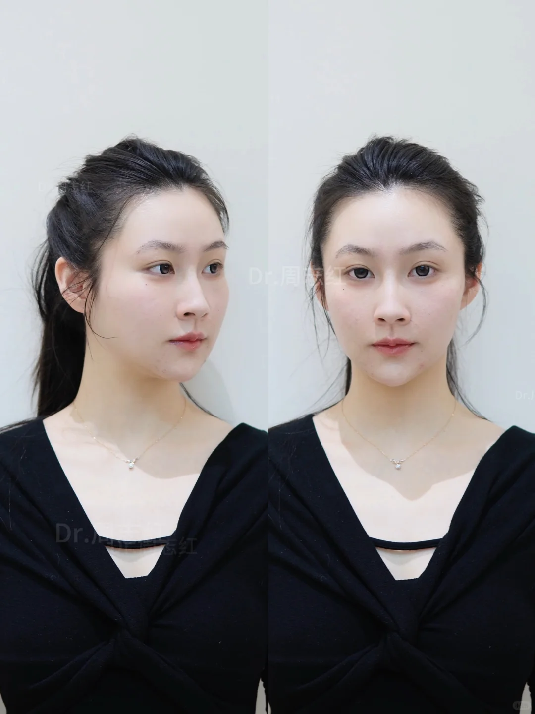 30+苦相脸变美思路，打造骨相感美女