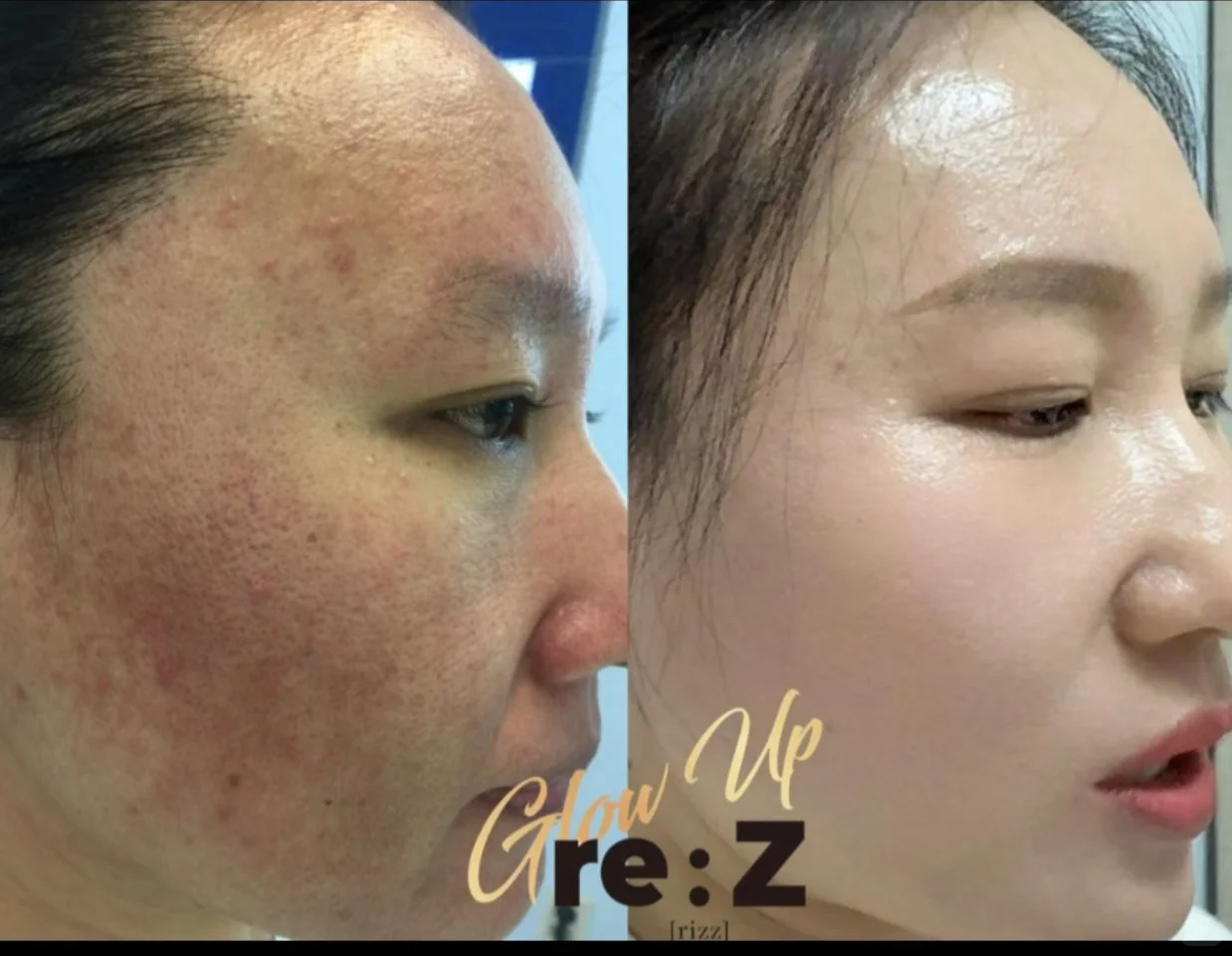 问题肌的“对症下药”