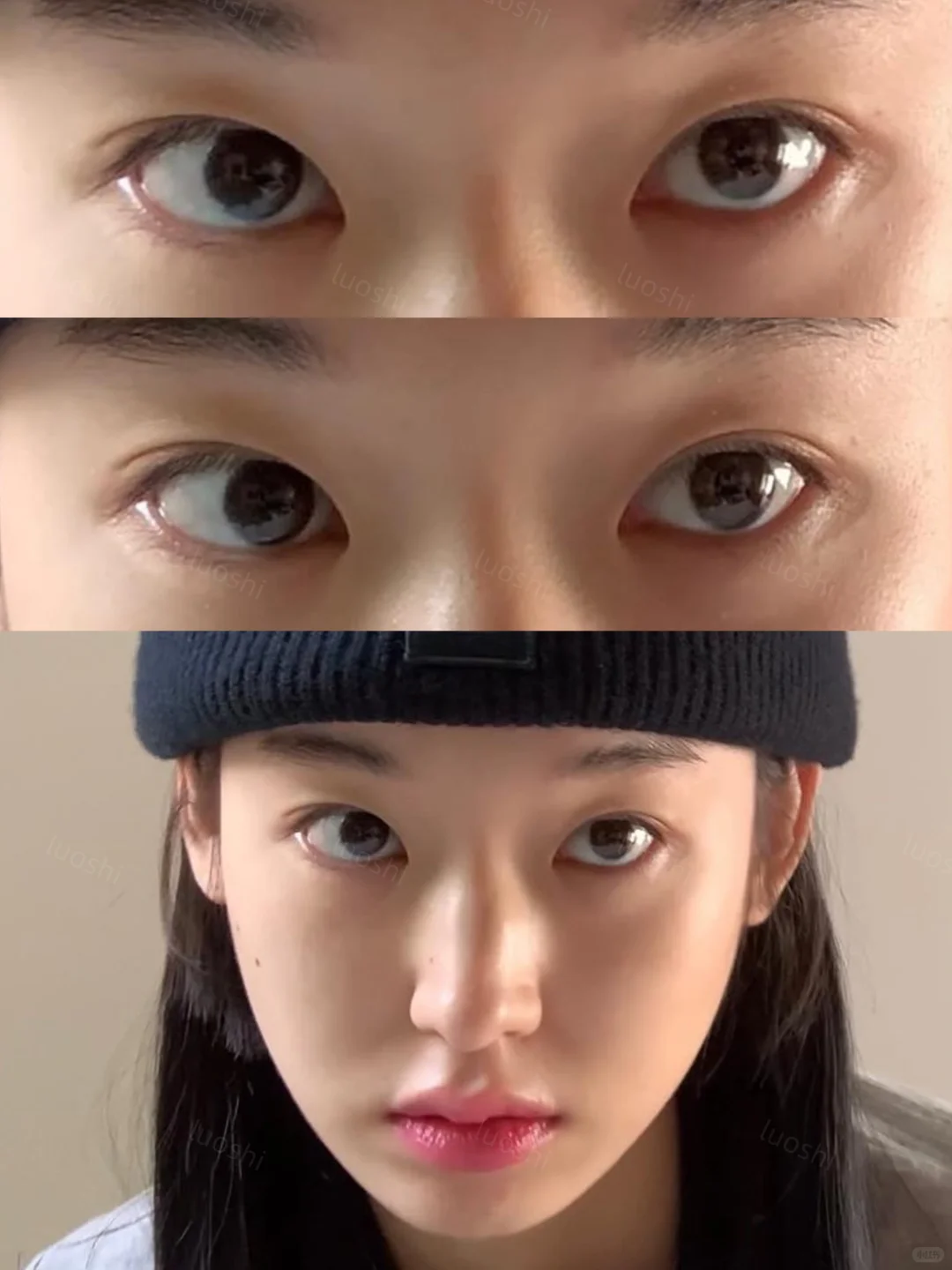 韩女都开始搞窄双了……双眼皮模板