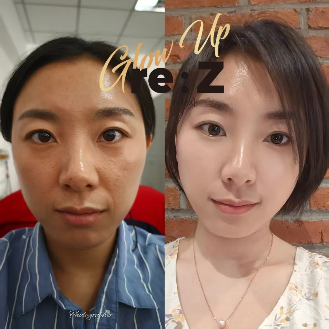 问题肌的“对症下药”