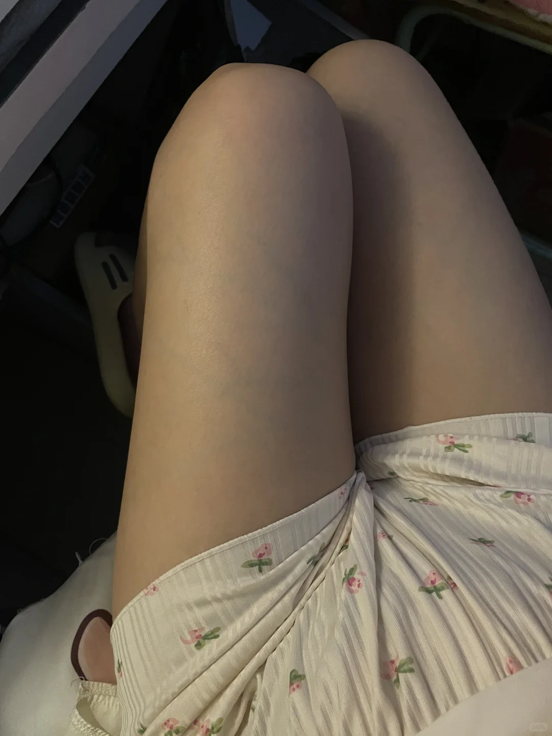 发现自己的青筋好明显