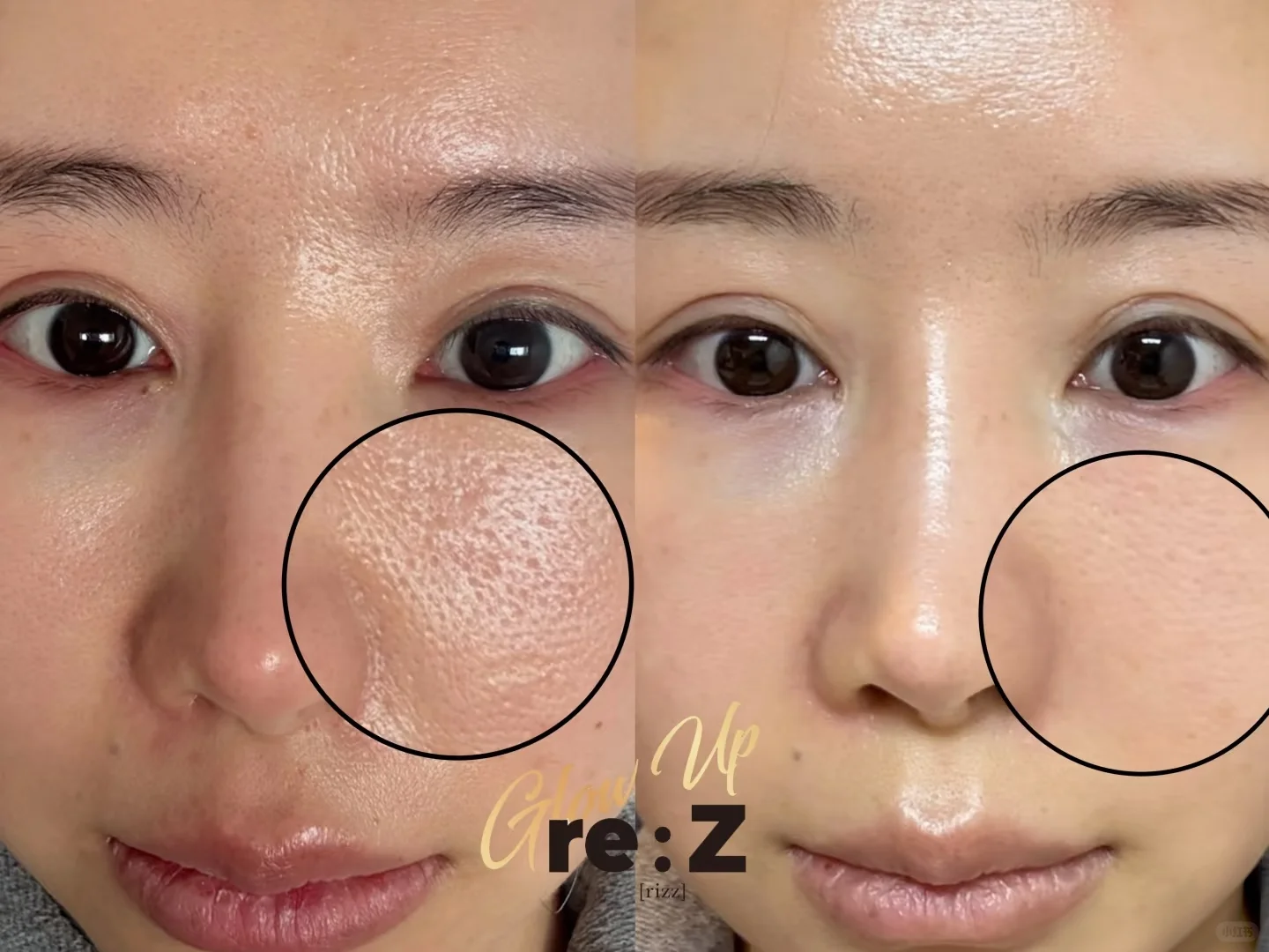 问题肌的“对症下药”