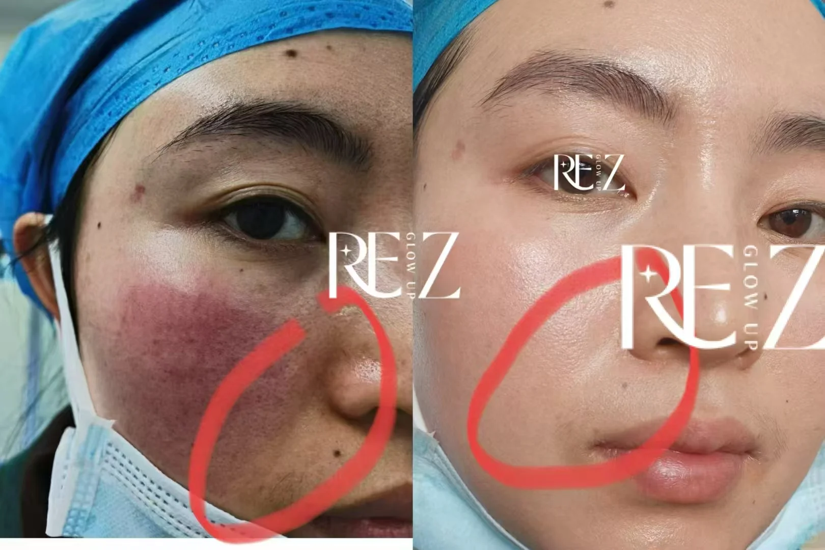 问题肌的“对症下药”