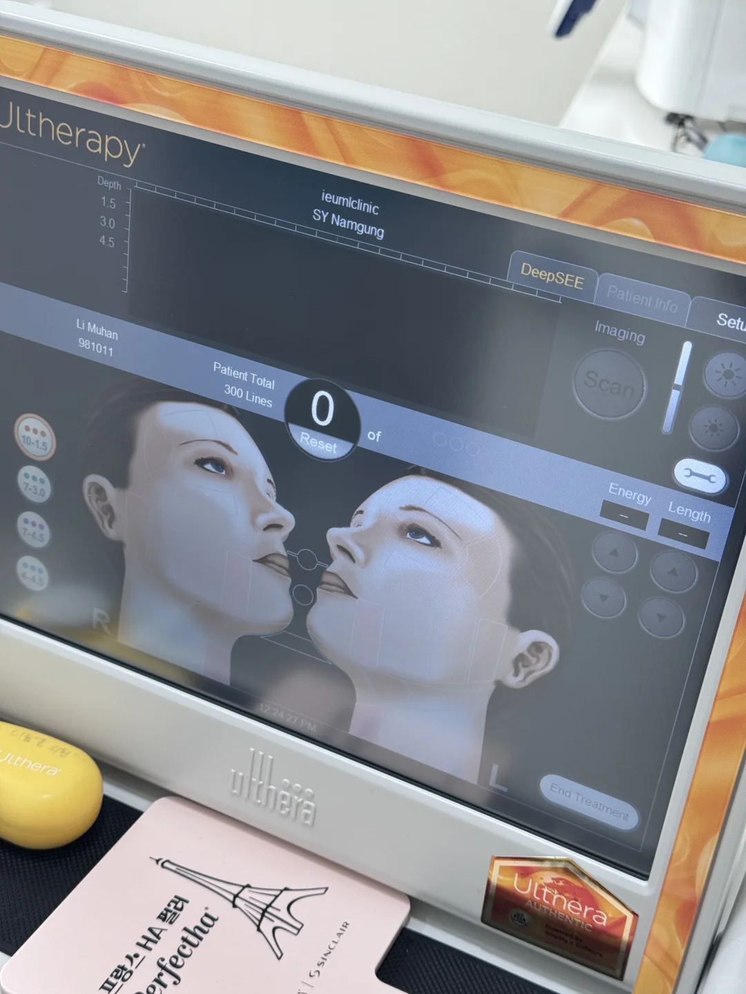 小韩医美后记📝之全脸肉毒+美刀