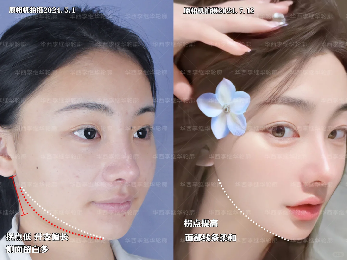 突兀感消失～视觉上更显温柔了