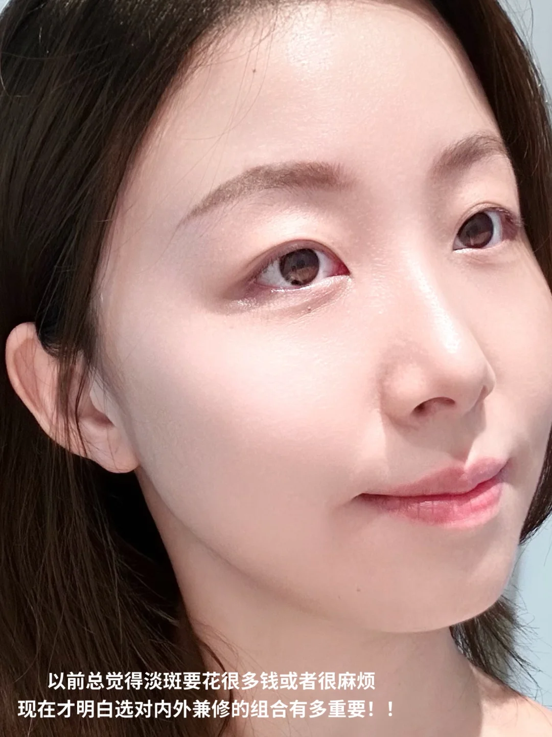 还在为斑点苦恼？白密码鲨疯了！