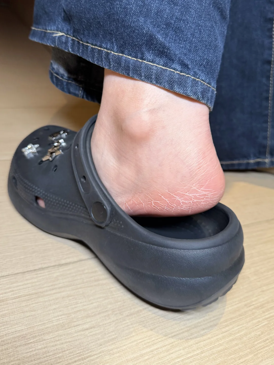 七夕被男友吐槽的树皮脚终于逆袭了！