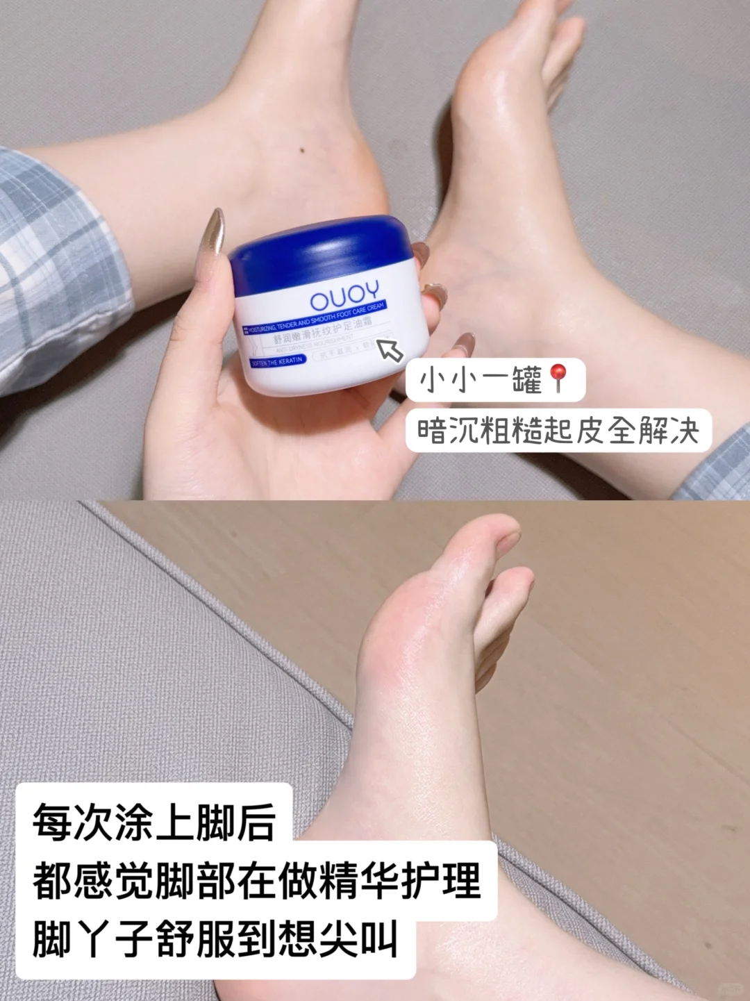 糙脚必备神器！嫩脚真的赢麻了！