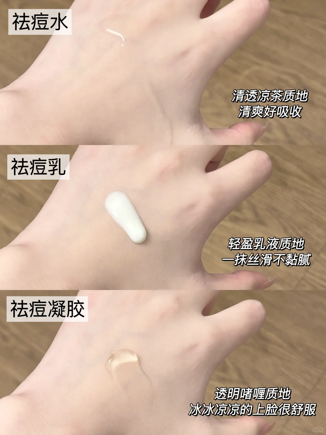 女大自用祛痘水乳！痘痘去无踪～✨