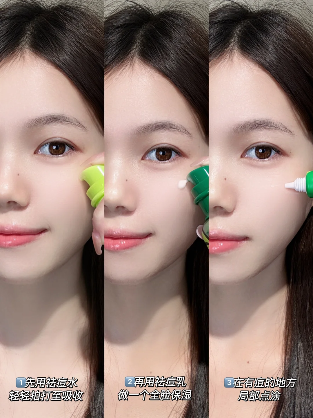 女大自用祛痘水乳！痘痘去无踪～✨
