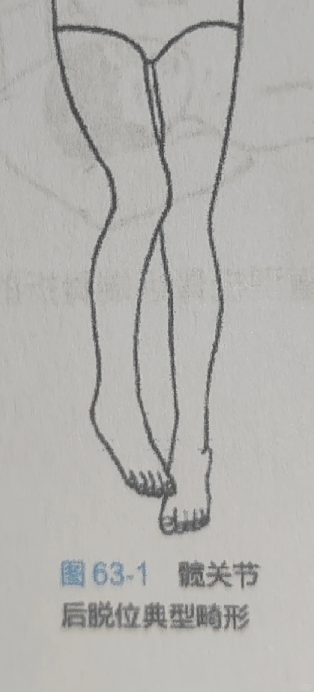 有多少二游女角色是这个腿型？