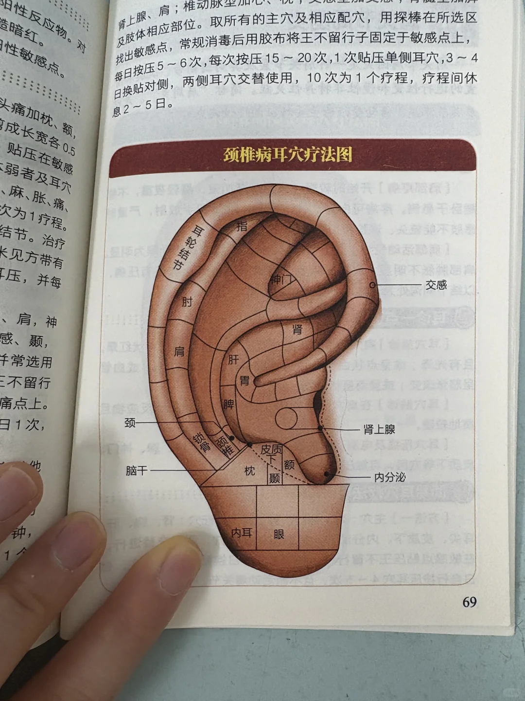 耳穴贴贴，真的有用吗？