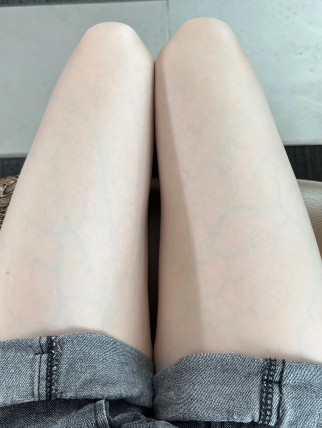 这血管看着有点太明显了吧！