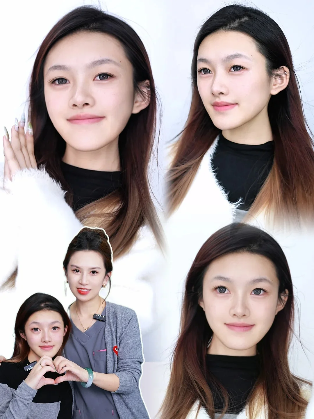 长沙到底有谁在啊？都来找郭凌宇微调变美~