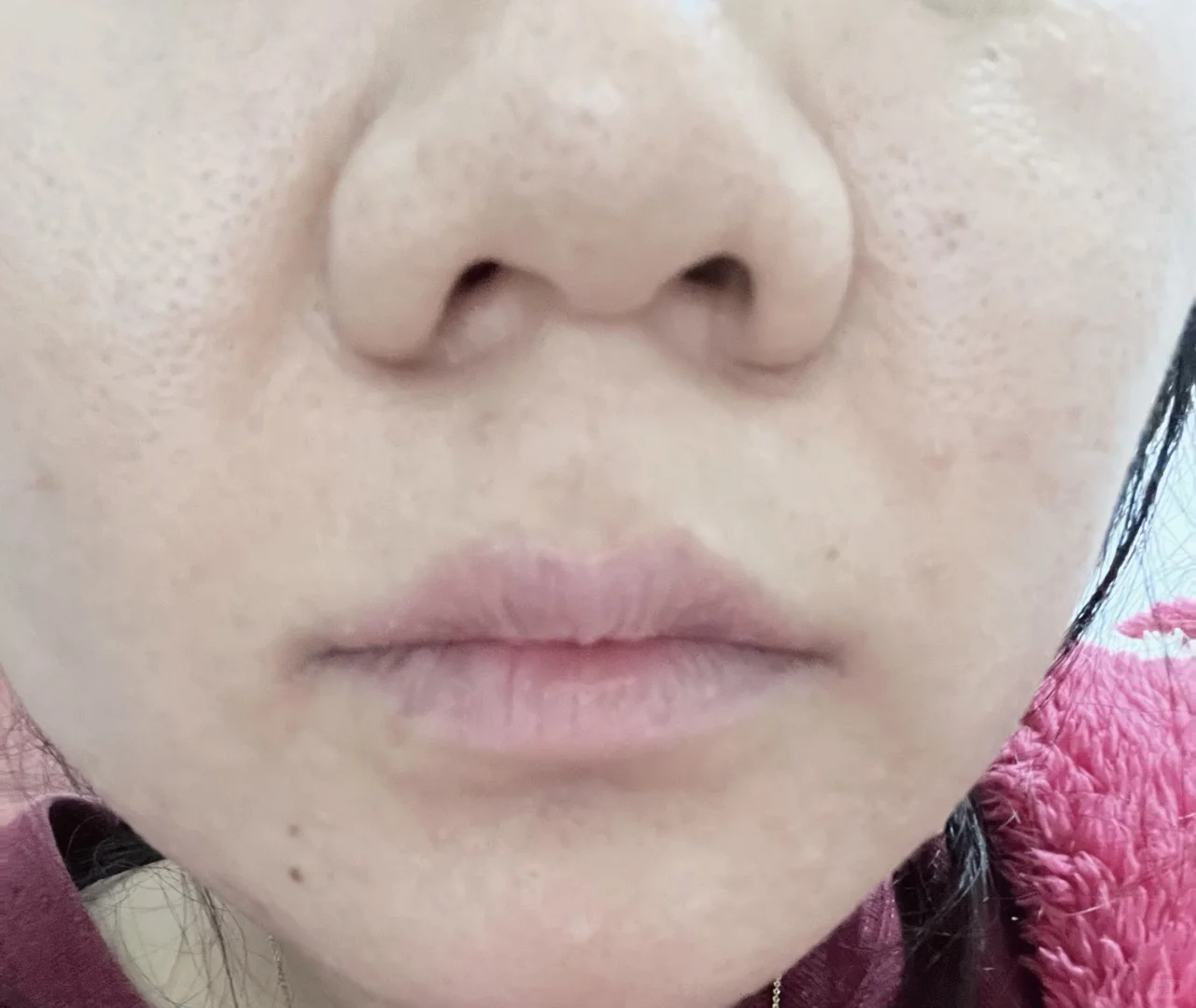 极萌大熨斗美容仪使用感受