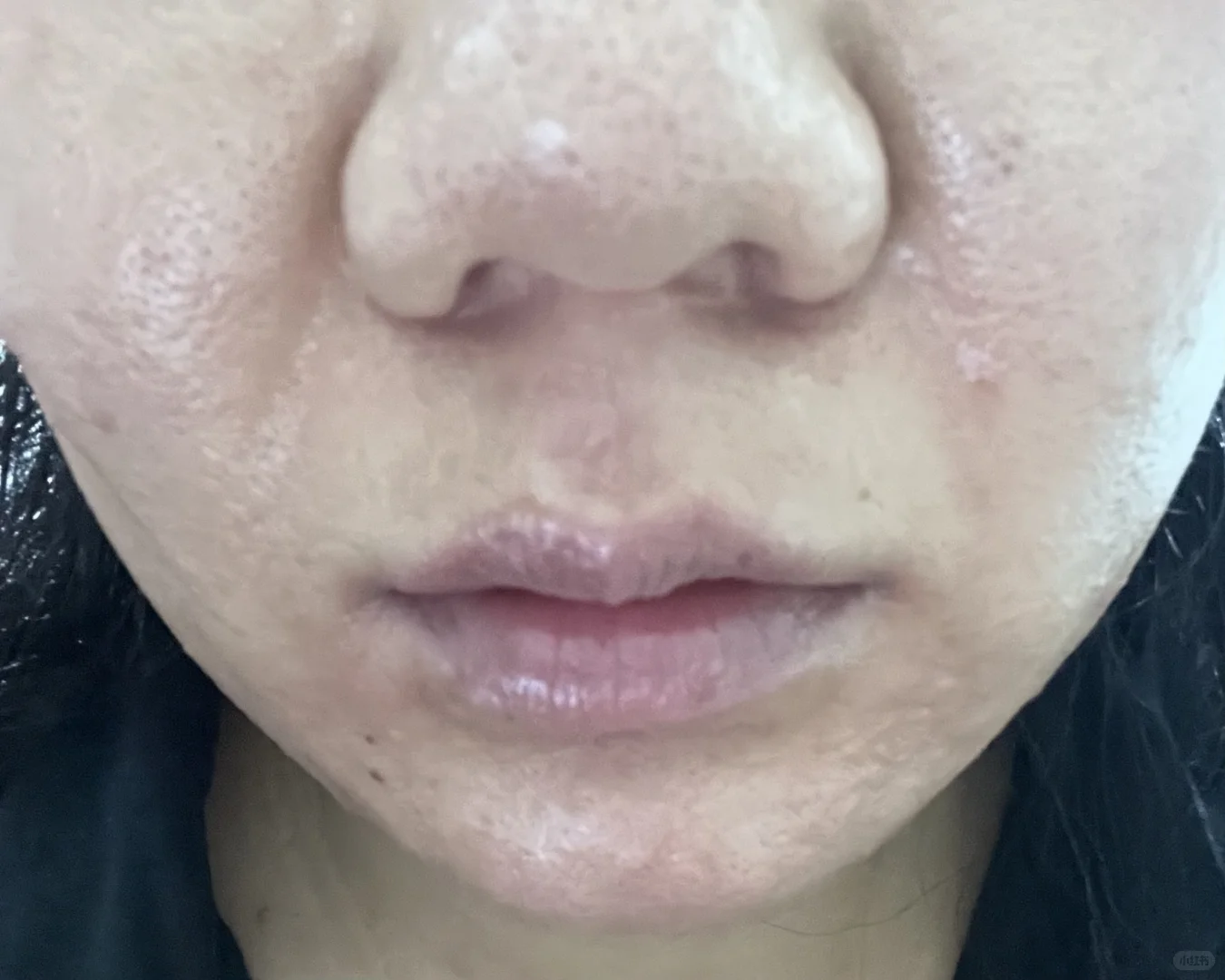 极萌大熨斗美容仪使用感受