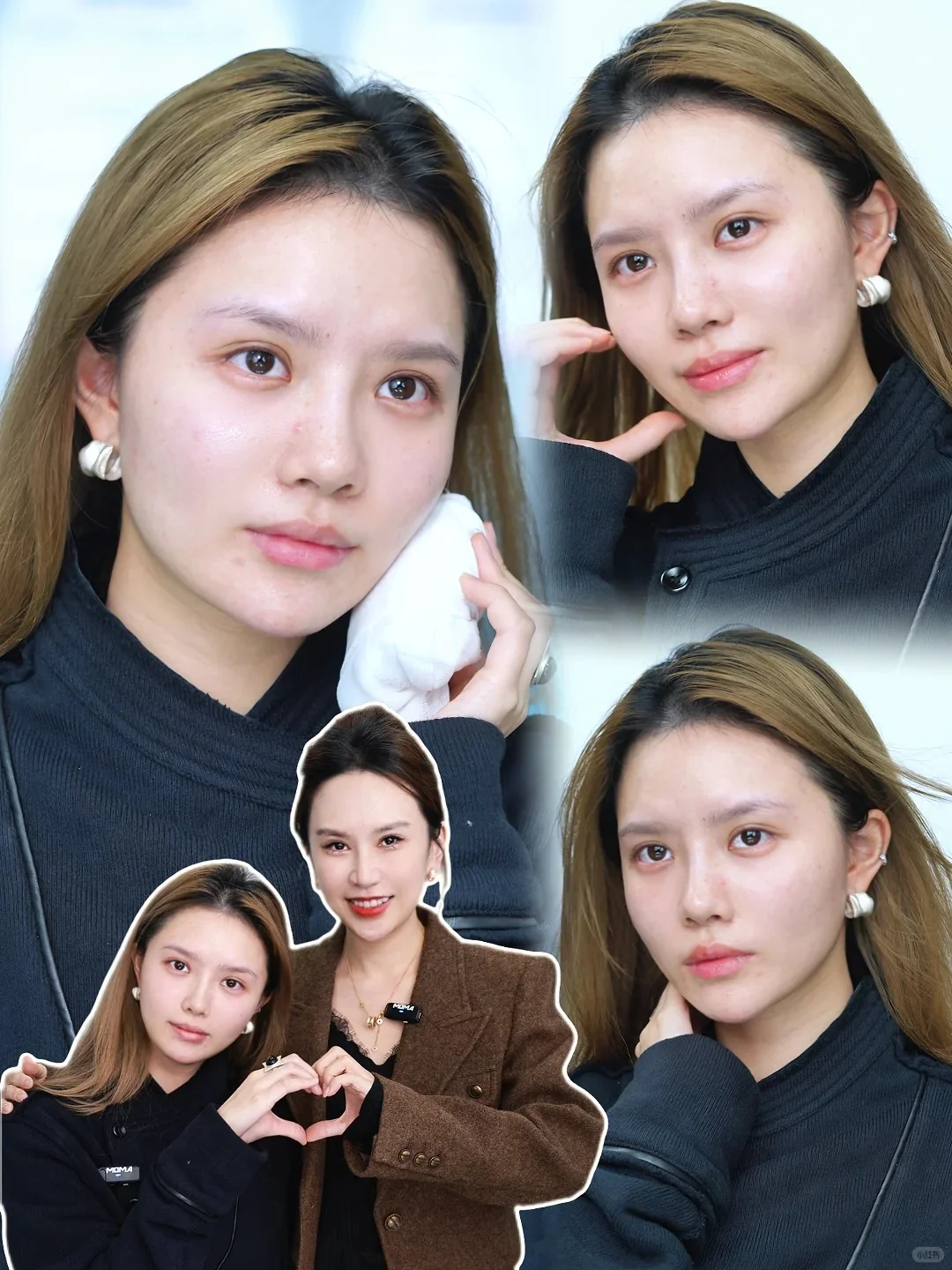 长沙到底有谁在啊？都来找郭凌宇微调变美~