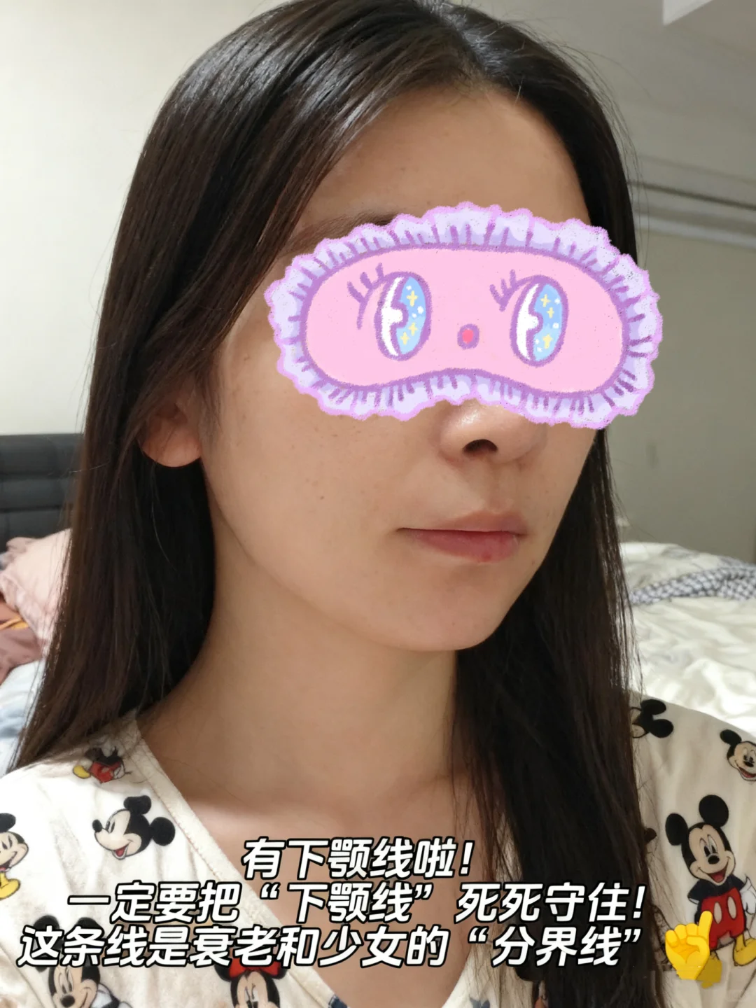 我也用上孟子义同款V脸绷带了‼️脸小到翻出