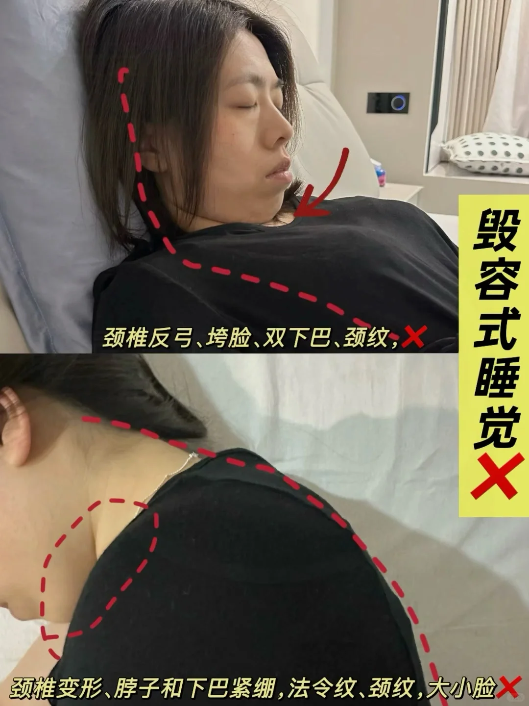 头扁脸扁下颌大😭这种侧脸，这样睡真能变美