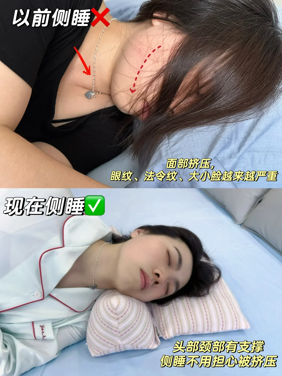 头扁脸扁下颌大😭这种侧脸，这样睡真能变美
