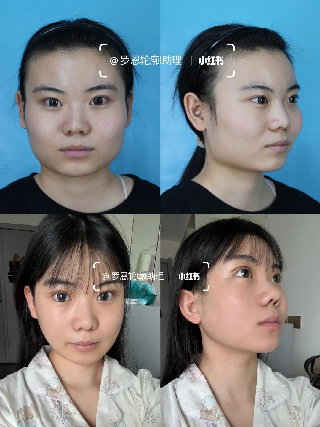 照抄！阔面脸的变美思路！