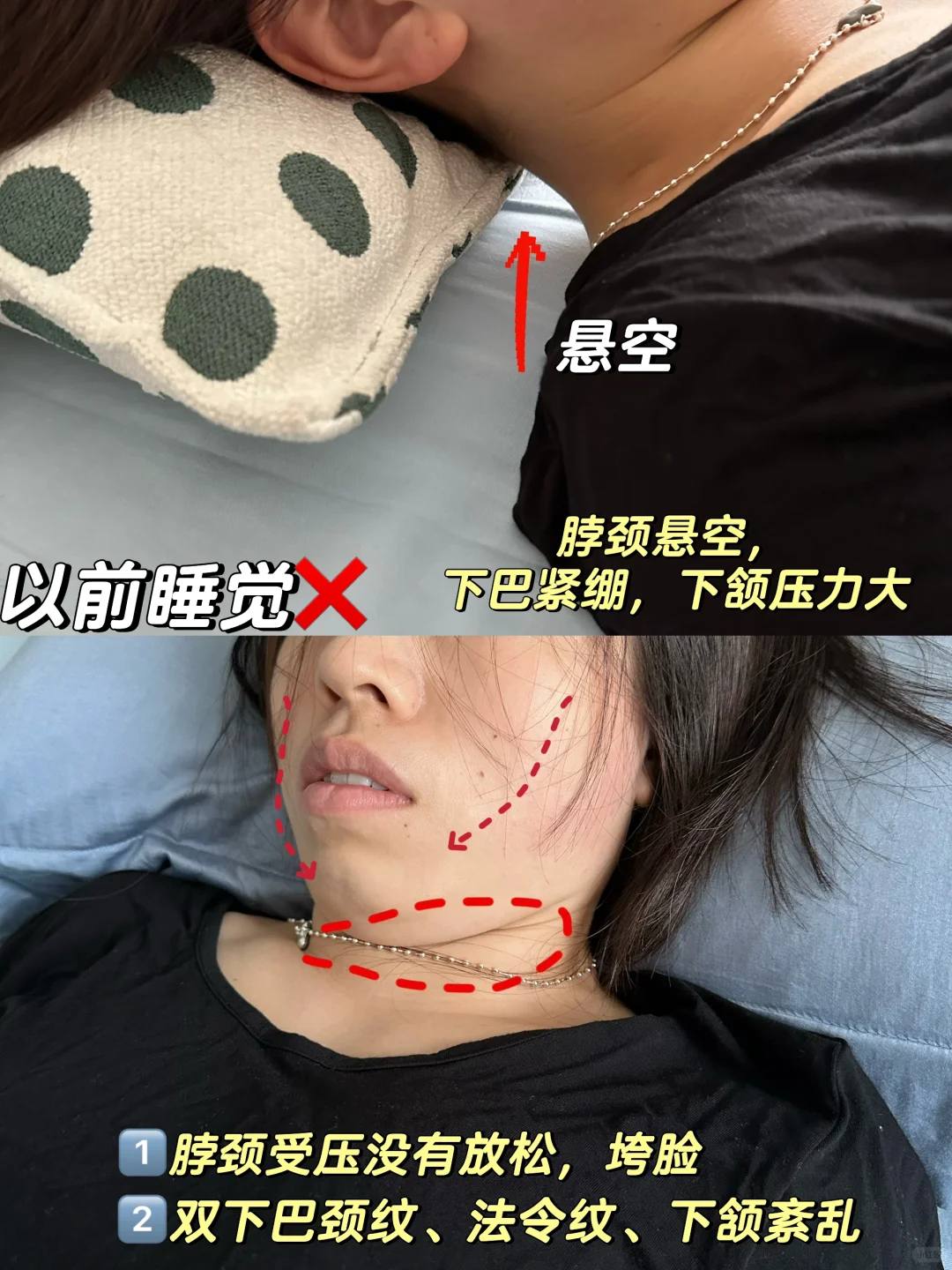 头扁脸扁下颌大😭这种侧脸，这样睡真能变美