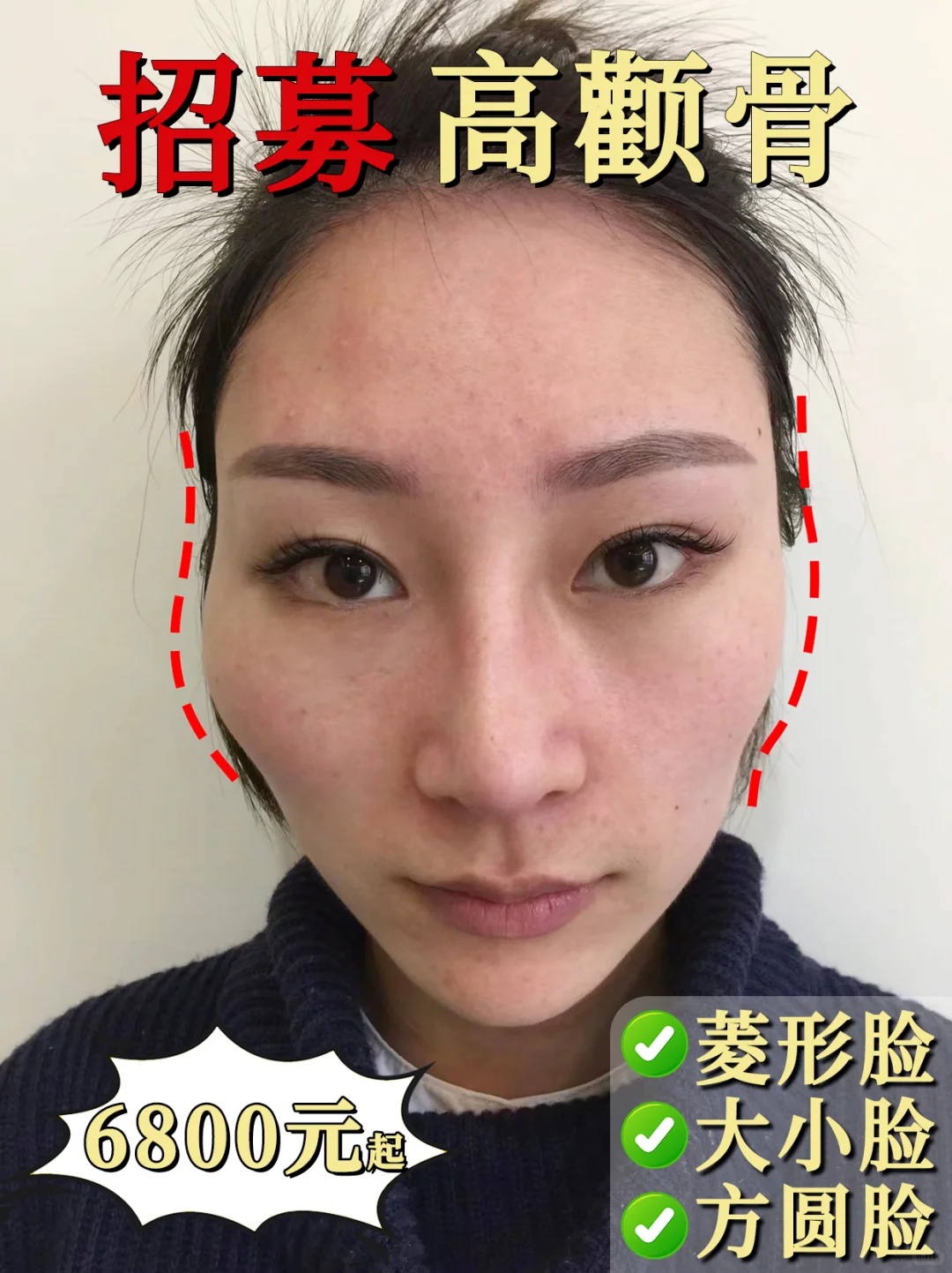 颧骨高、太阳穴凹、菱形脸的姐妹进！