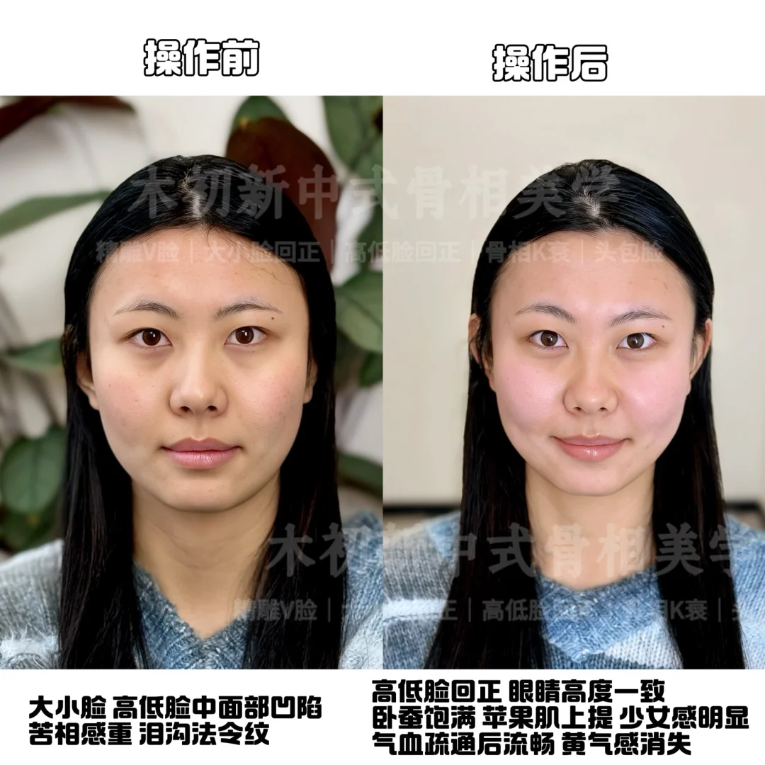 谁懂啊！什么项目都没做但就是偷偷变美了✅